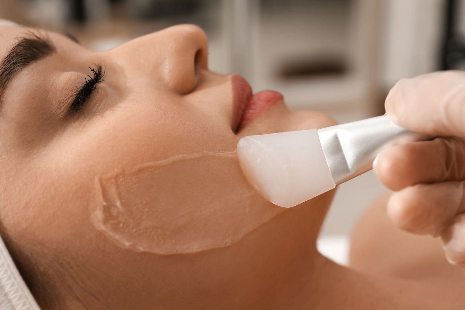 Can you wash your face right after a chemical peel?