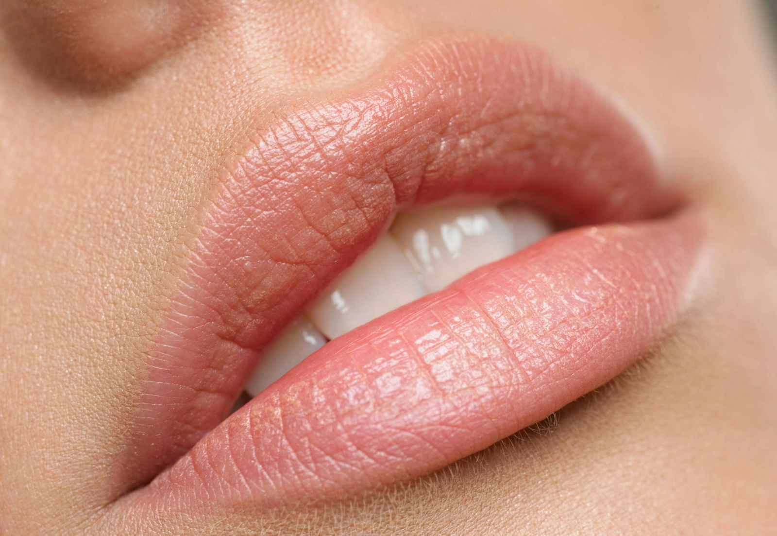 How long should you actually wait between lip fillers?
