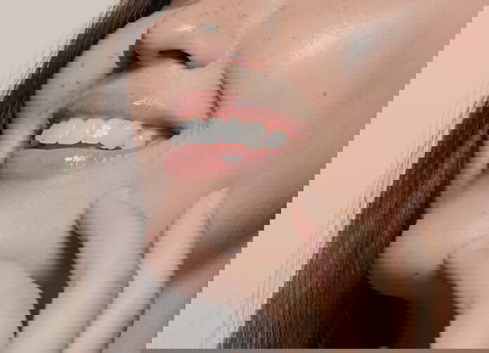 How Long Does it (Actually) Take for Lip Fillers to 'Settle'?