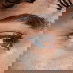 botox forehead eyebrows