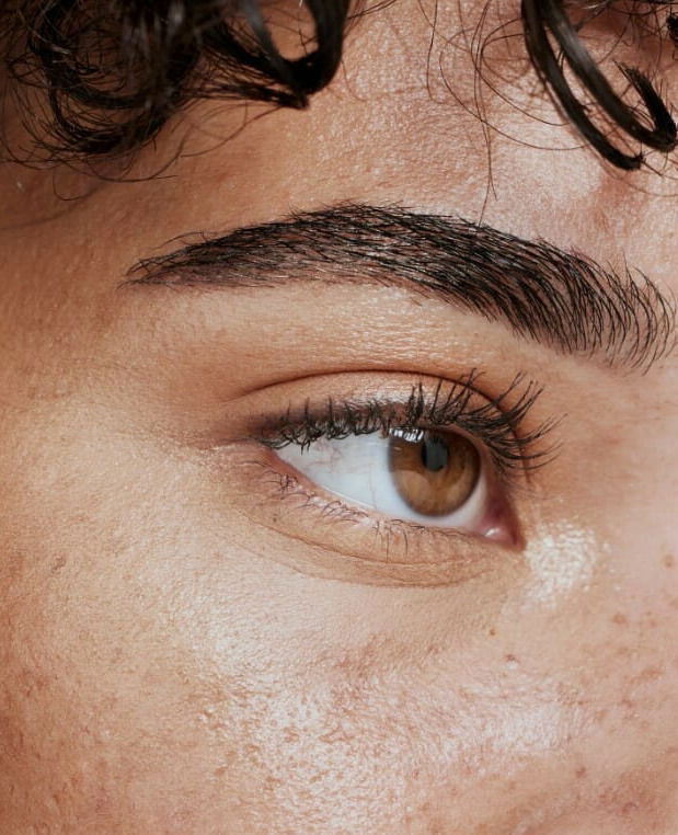 botox forehead eyebrows