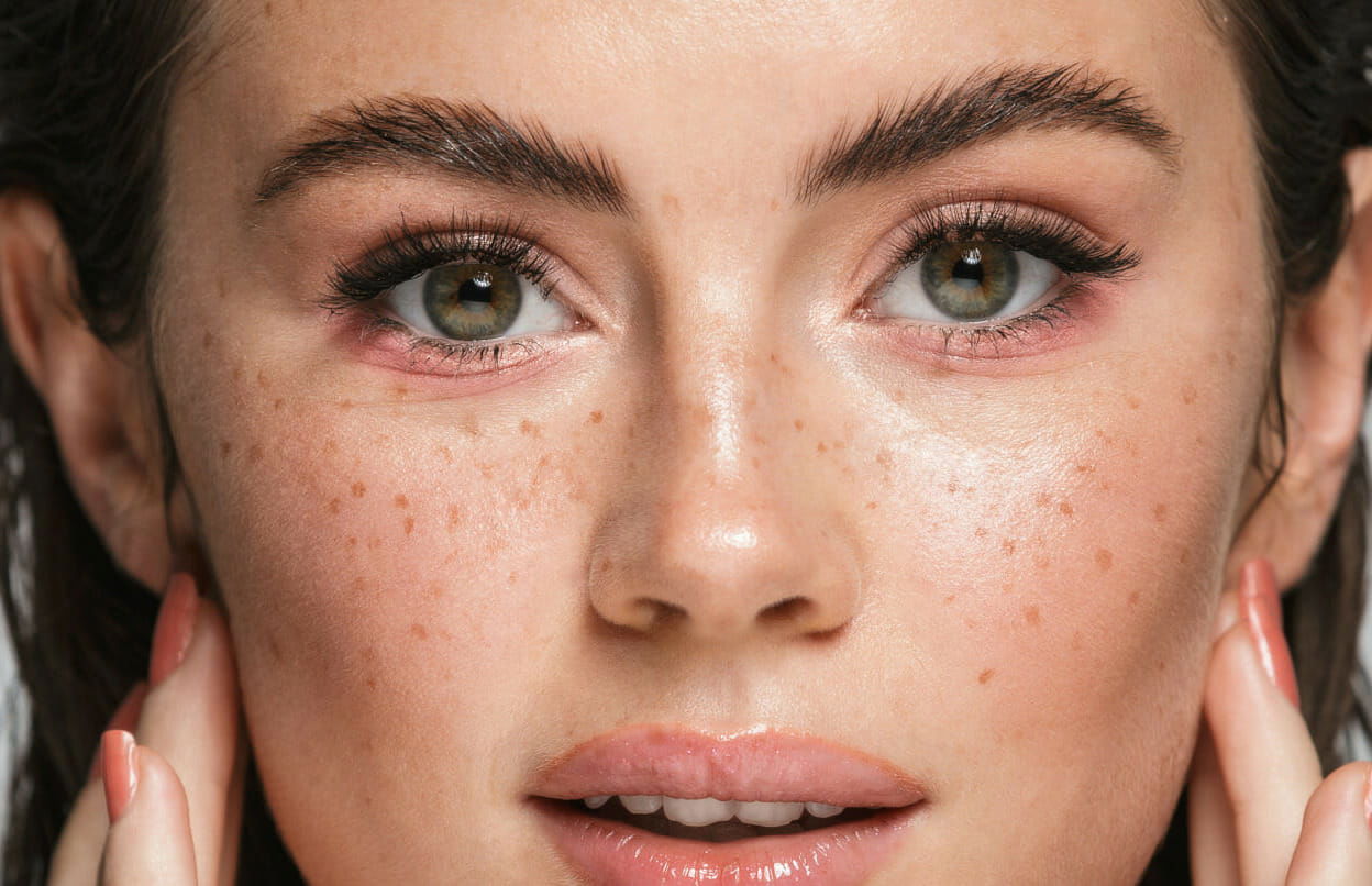 How Long Do Chemical Peel Results (Really) Last?