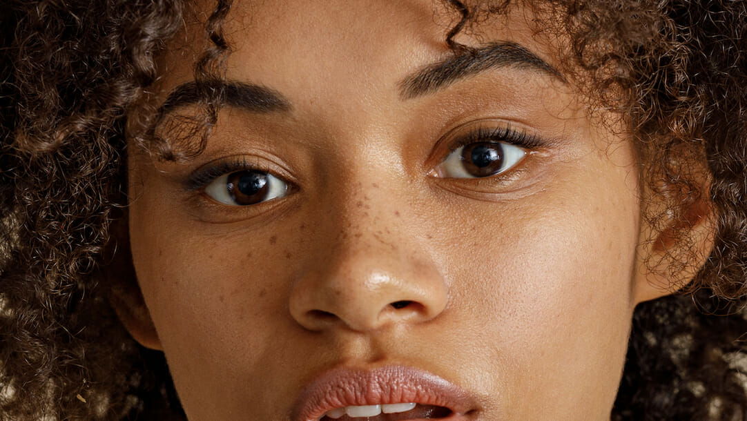 Can Botox Really Help lift your eyebrows?