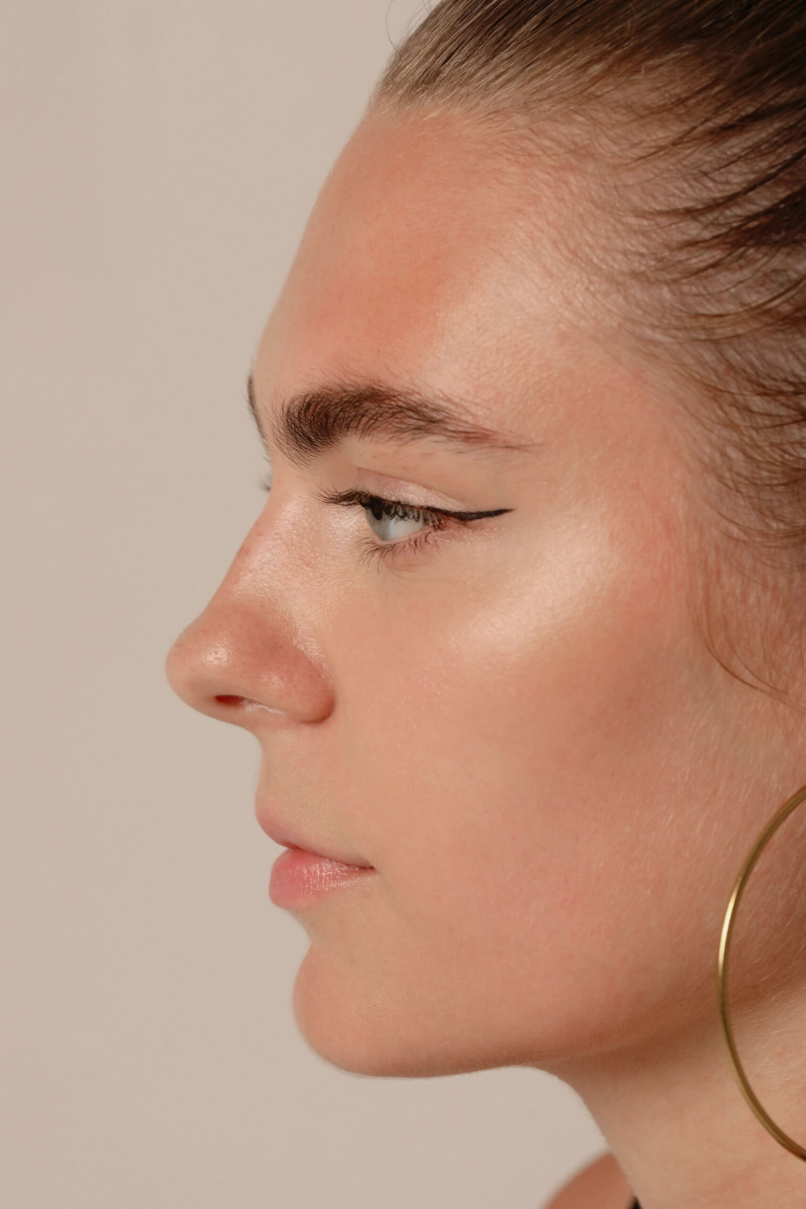 Can Botox Really Help lift your eyebrows?