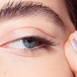 where on your face can you get Botox woman eye wrinkles