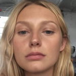 Model Laura D'Chova with clear skin after her journey with rosacea
