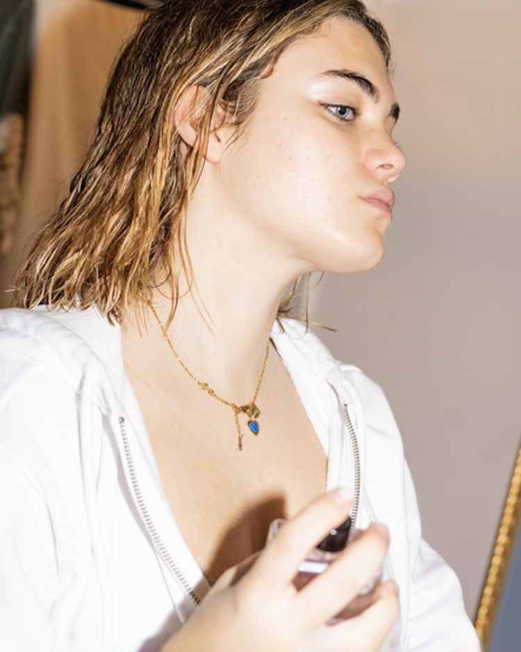 Woman with acne showing how to get rid of acne redness