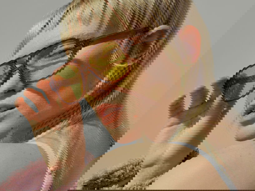 Woman with acne redness showing how to get rid of redness from acne