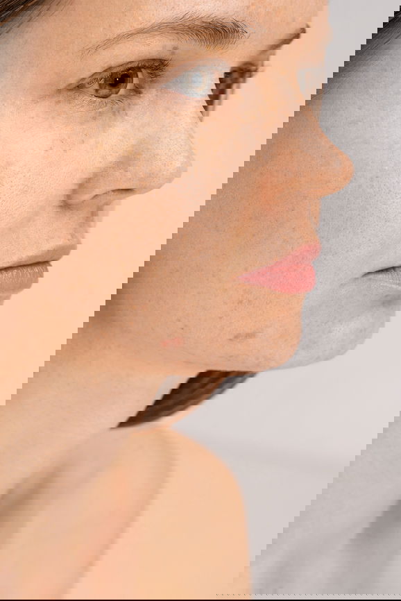 Close-up portrait of young woman with problem skin and freckles on face in studio