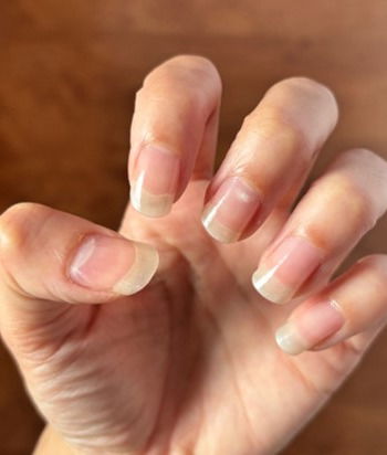 biting nails nail growth products