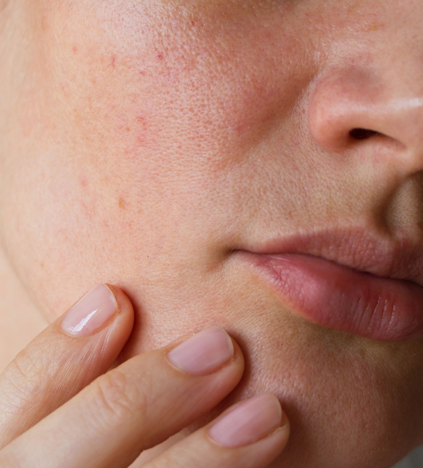 can you shrink pores dry skin acne skincare