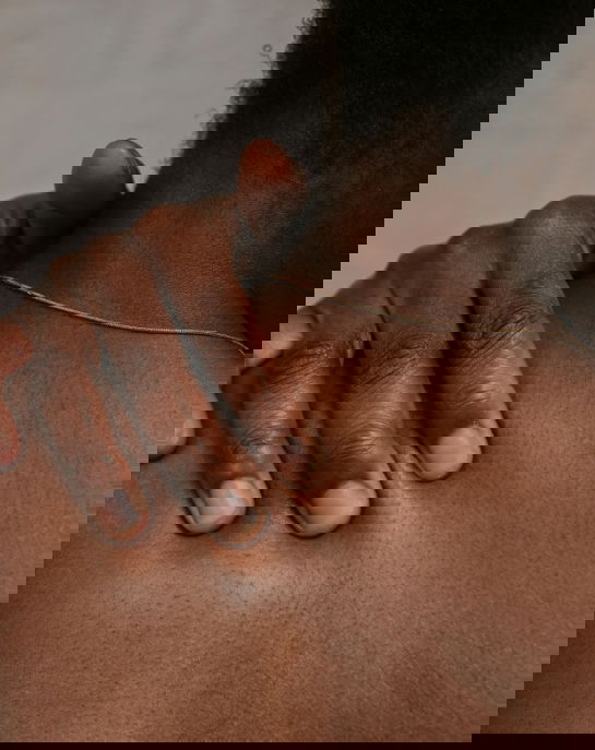 what is hyperpigmentation