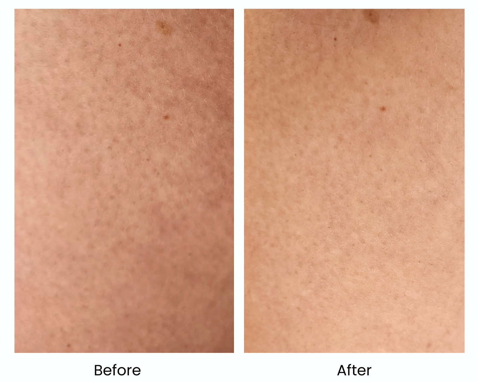 Light Blue White Clean Grid Family Photo Collage | Live That Glow